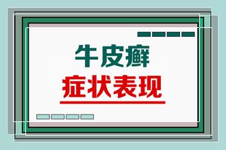 青少年治疗牛皮癣的方法和注意事项有哪些