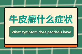 牛皮肤癣饮食要注意什么？食谱不能少了这些，不然病情加重没商量