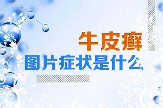 皮肤癣【牛皮癣】饮食要注意什么？戒烟一小步，“除癣”一大步！